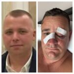 Ferhat Kaja i lokaleve Stockholm dhunoi brutalisht biznesmenin Laert Kasajn për një shkrim te JOQ. Grupi kriminal lidhje me Eldi Dizdarin? Policia dhe SPAK nuk veprojnë